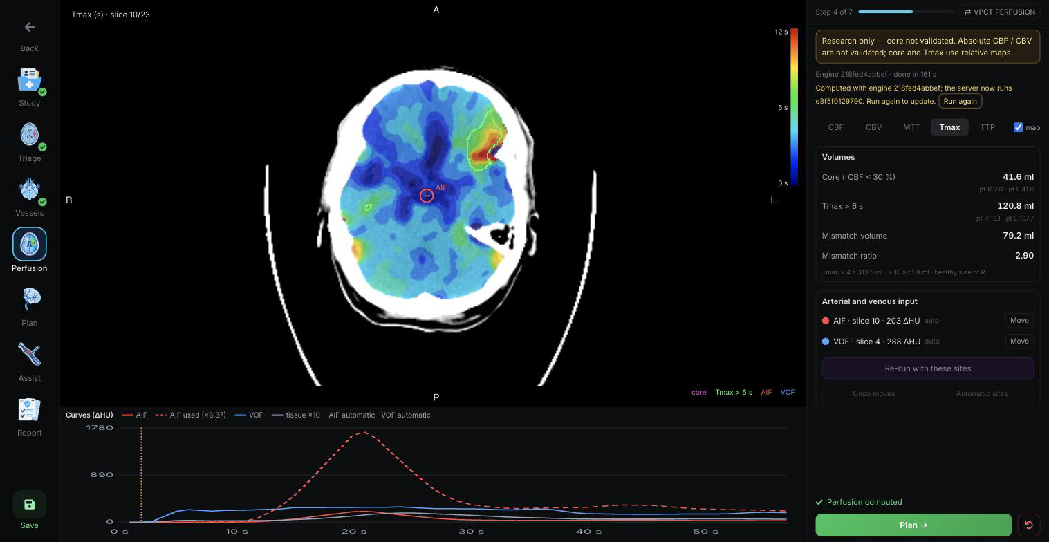 QuanSTROKE · CT perfusion map and volumes