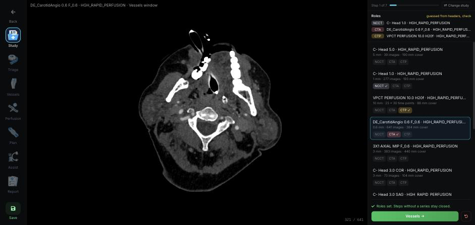 QuanSTROKE · CT series selection and study review